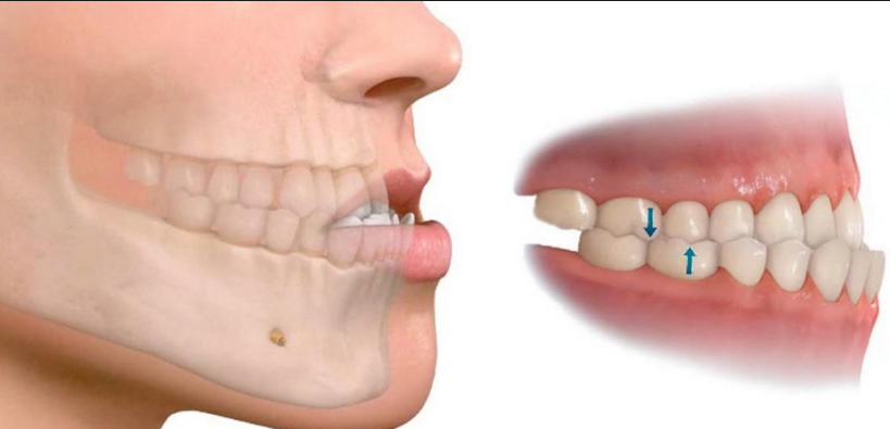 Cirugia maxilofacial en odontología