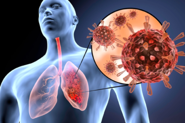 alérgia y una infección respiratoria