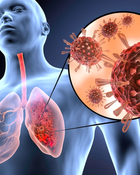 alérgia y una infección respiratoria