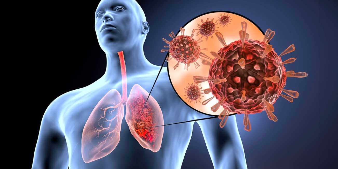 alérgia y una infección respiratoria