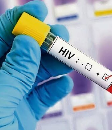 prueba carga viral