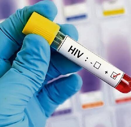 prueba carga viral